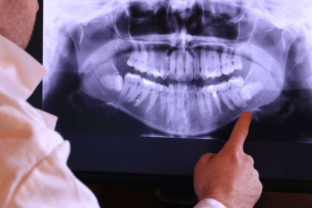 Best Broken or Chipped Tooth Repair in Danvers, IL