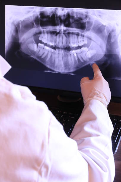 Best Emergency Root Canal Therapy in Danvers, IL